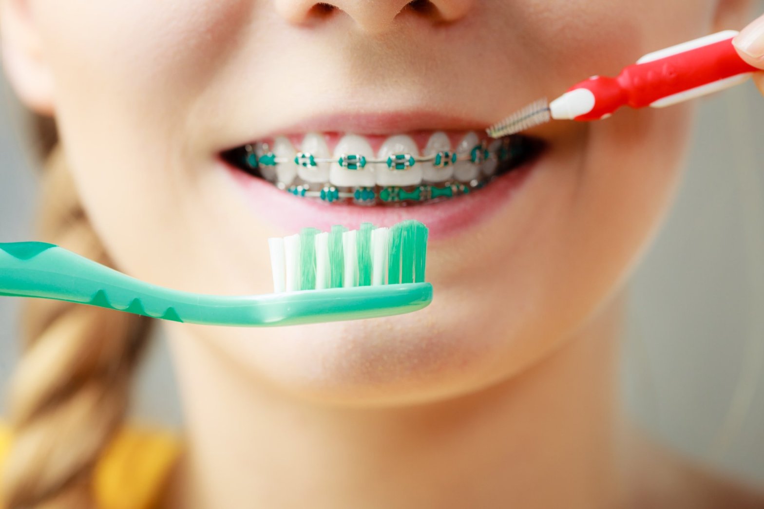 Virginia Family Dentist